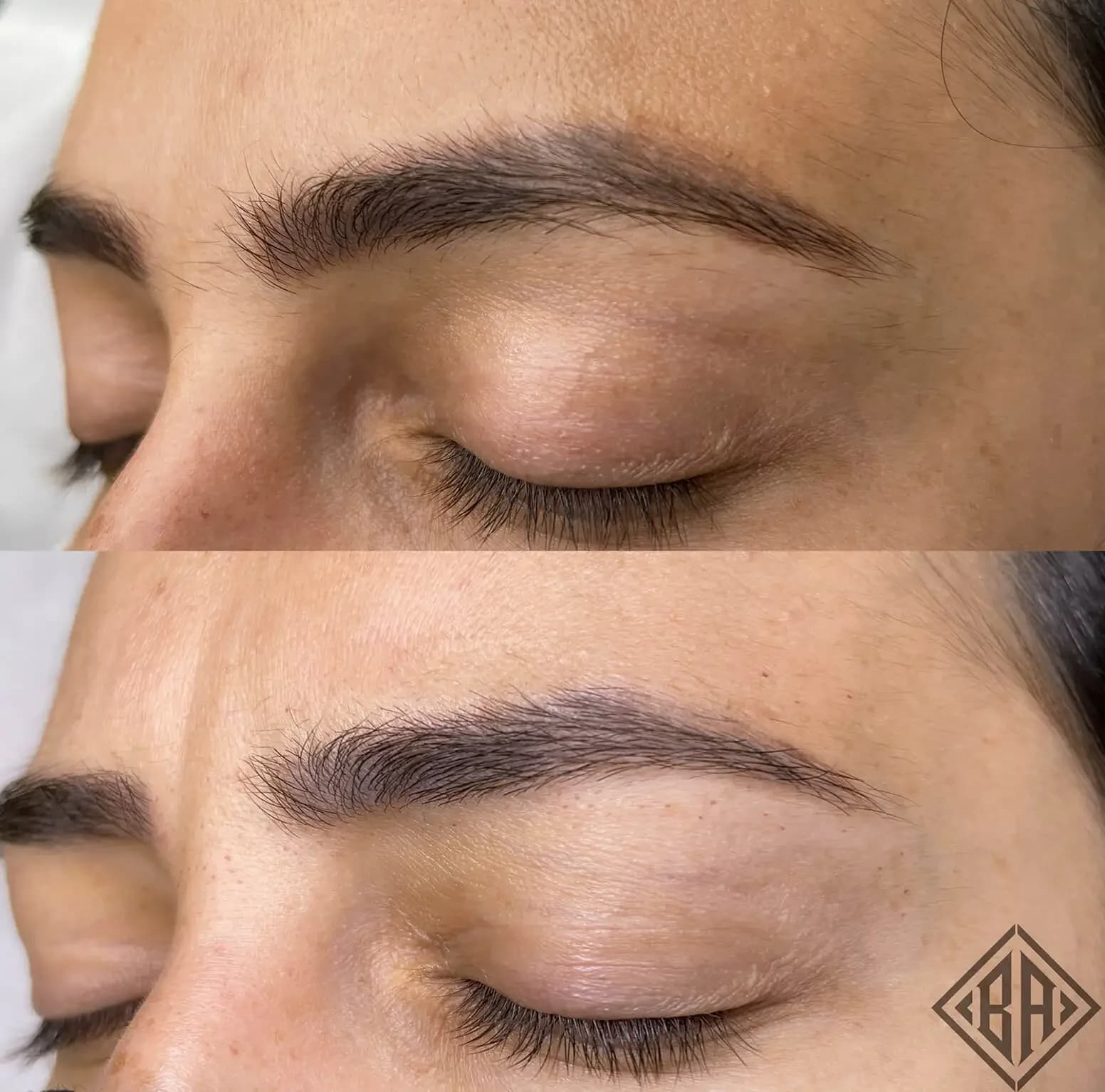 Beauty Angels Laser-Free Tattoo Removal — Beauty Art Pro, Geneva