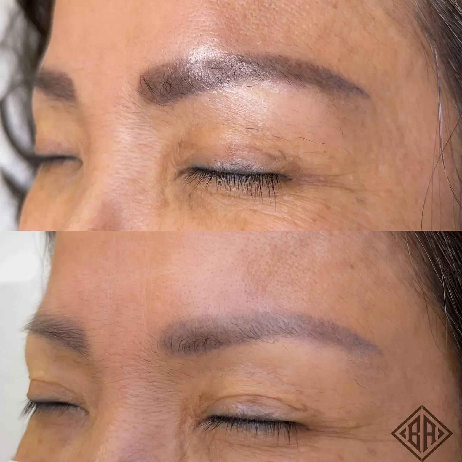 Beauty Angels Laser-Free Tattoo Removal — Beauty Art Pro, Geneva (2)