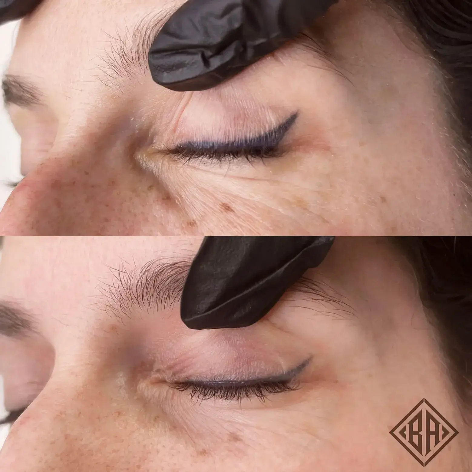 Beauty Angels Laser-Free Tattoo Removal — Beauty Art Pro, Geneva (3)