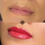 lip blush result before and after 4