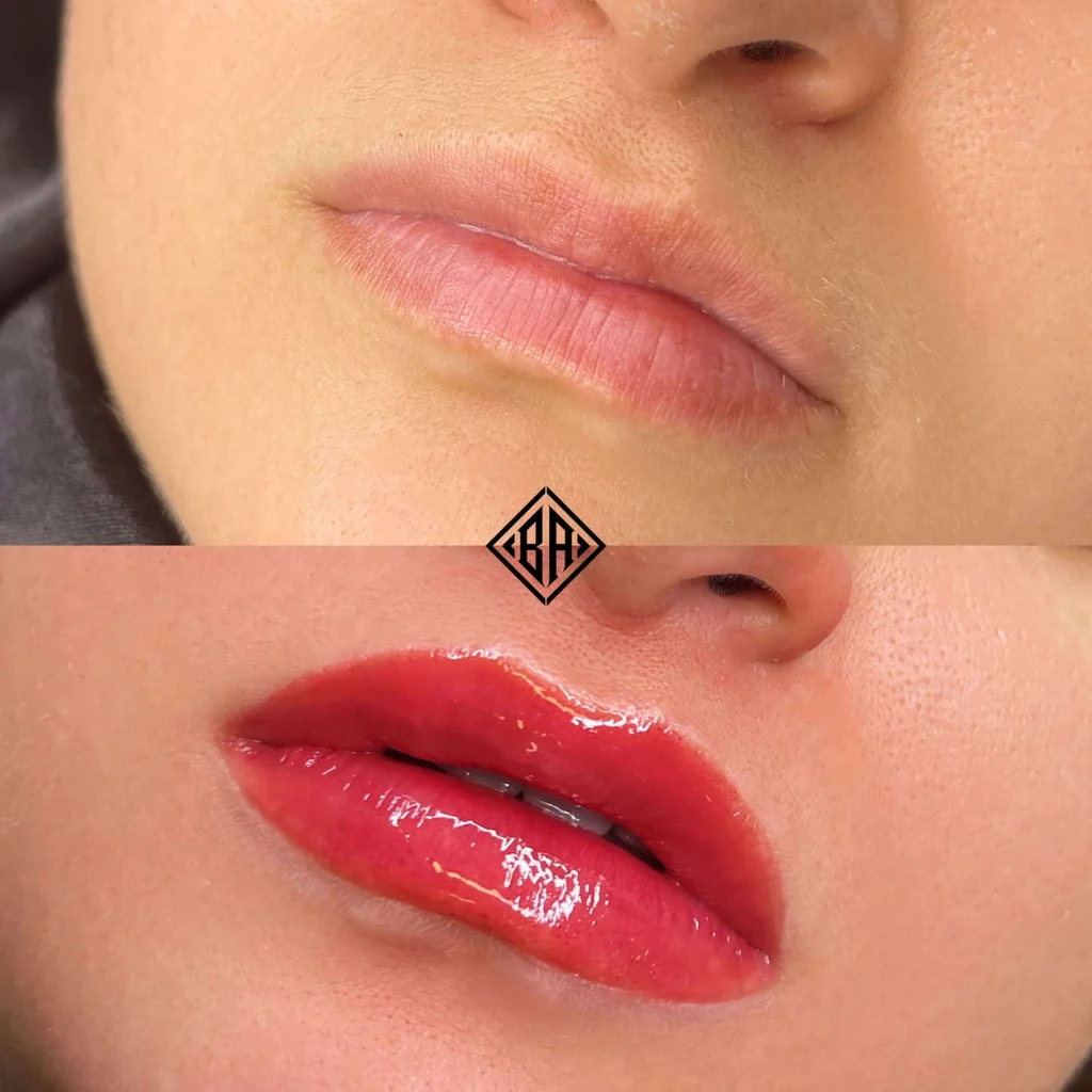 lip blush result before and after 5